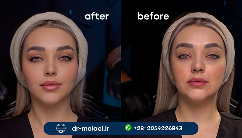 نمونه کار